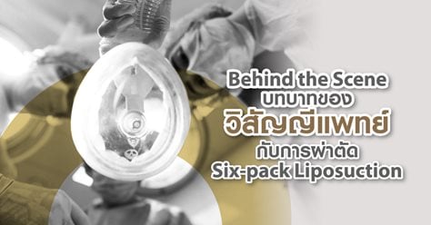 Behind the Scene บทบาทของวิสัญญีแพทย์กับการผ่าตัด Six-pack Liposuction
