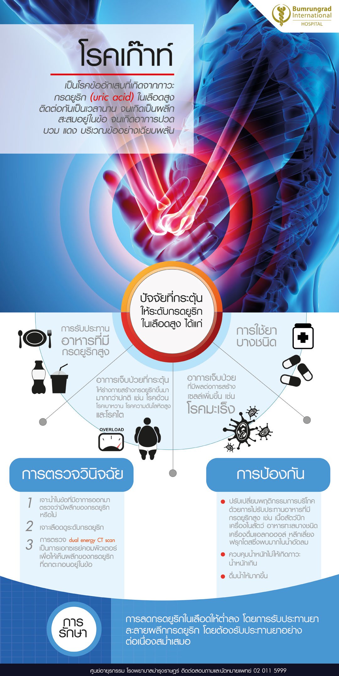 โรคเกาท-web.jpg