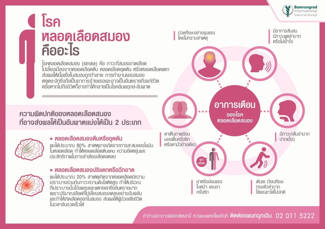 โรคหลอดเลือดสมอง คืออะไร