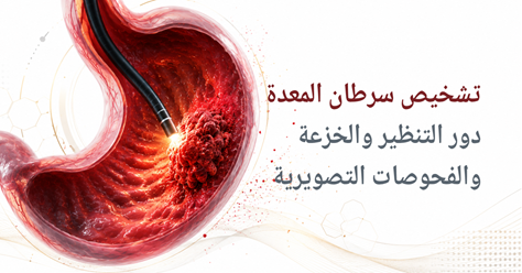 تشخيص سرطان المعدة: دور التنظير والخزعة والفحوصات التصويرية
