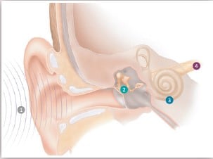 Process of Hearing explanation