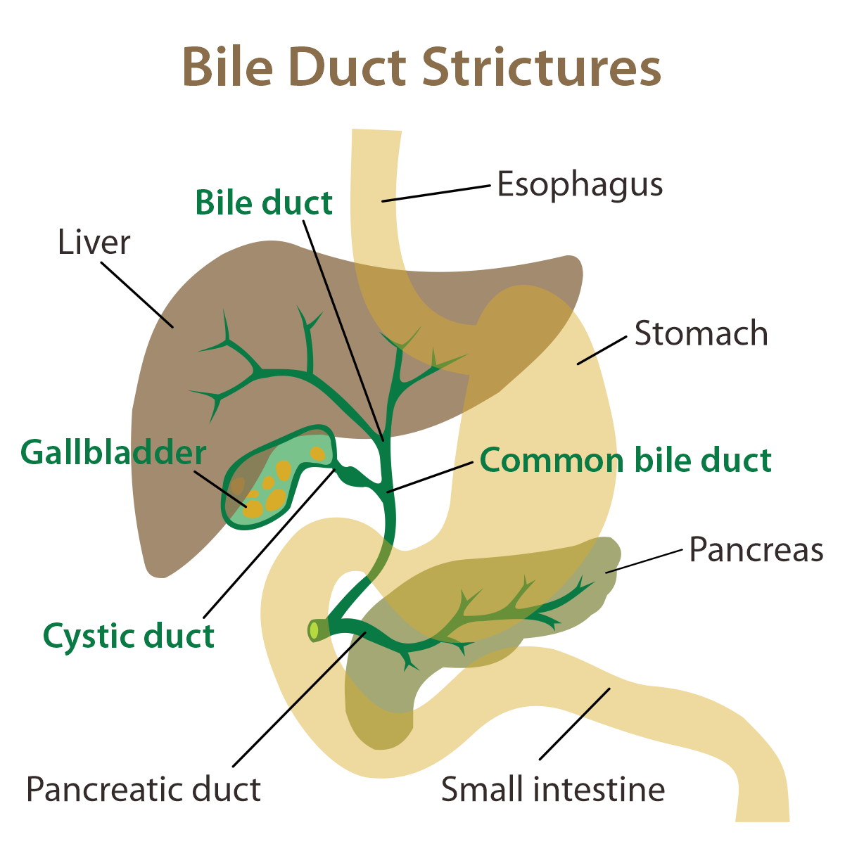 New American guidelines on how to deal with a blocked bile duct