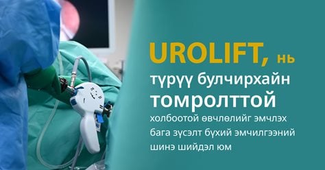 UROLIFT нь түрүү булчирхайн томролттой холбоотой өвчлөлийг эмчлэх бага зүсэлт бүхий эмчилгээний шинэ шийдэл юм 