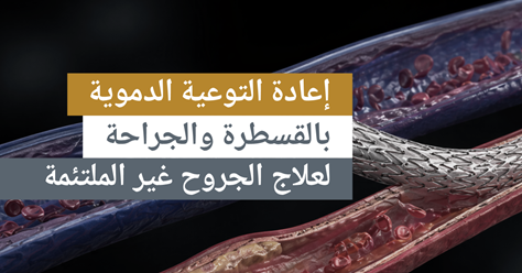إعادة التوعية الدموية بالقسطرة والجراحة لعلاج الجروح غير الملتئمة
