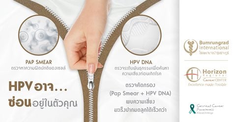 HPV - Zip Up Challenge: HPV อาจ...ซ่อนอยู่ในตัวคุณ
