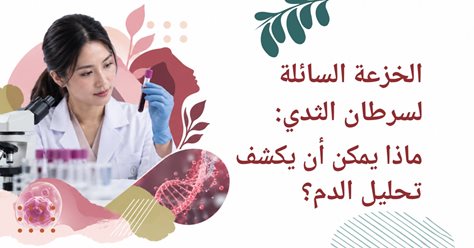الخزعة السائلة لسرطان الثدي: ما الذي يمكن أن يكشفه فحص الدم؟