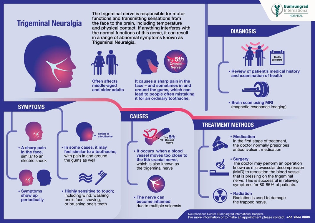 Trigeminal Neuralgia Infographic
