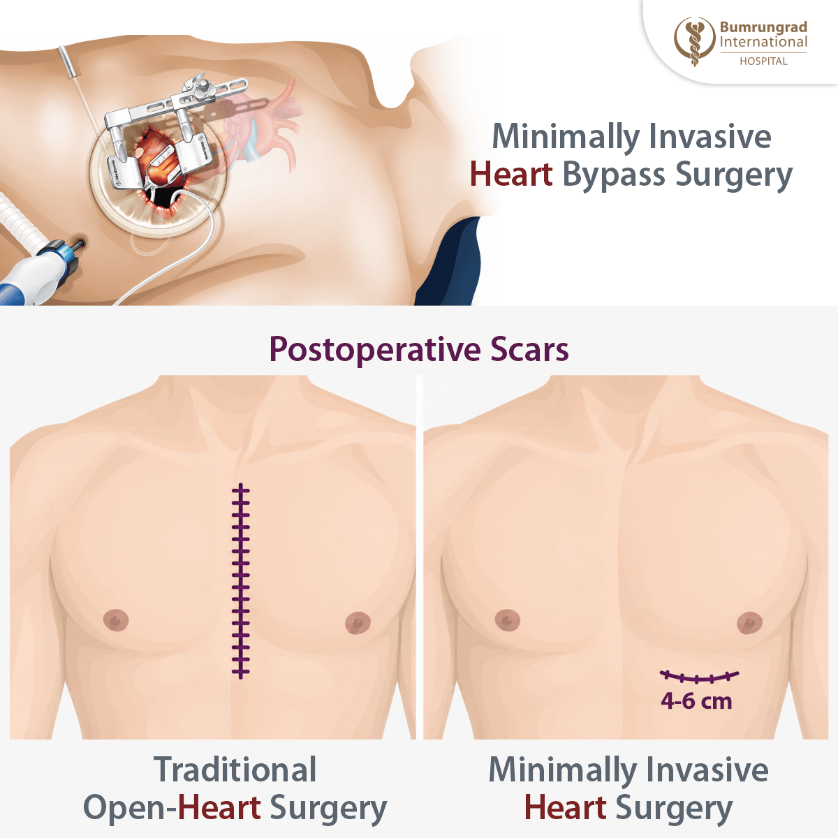 Heart-infographics.png