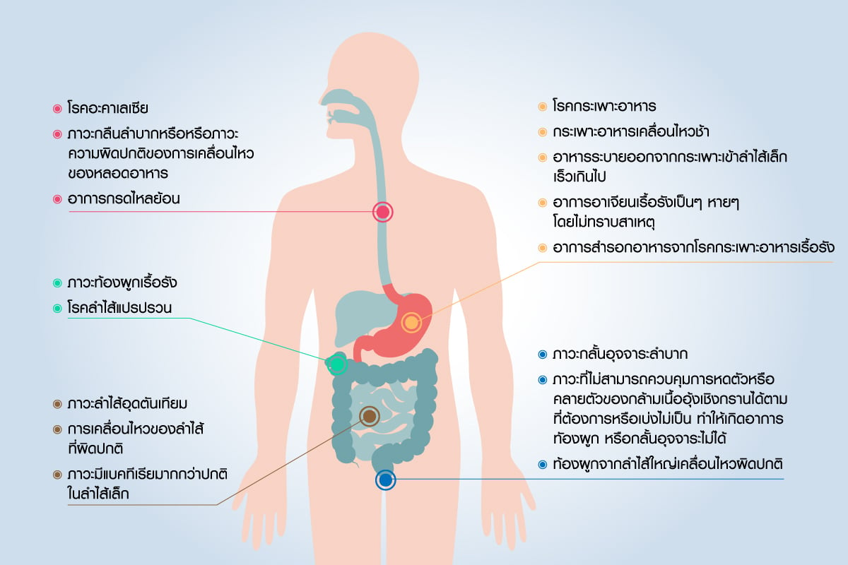 โรคการเคลื่อนไหวของระบบทางเดินอาหารคืออะไร