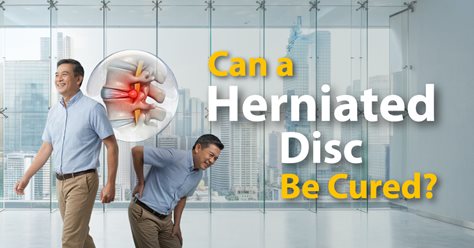 Can a Herniated Disc Be Cured?