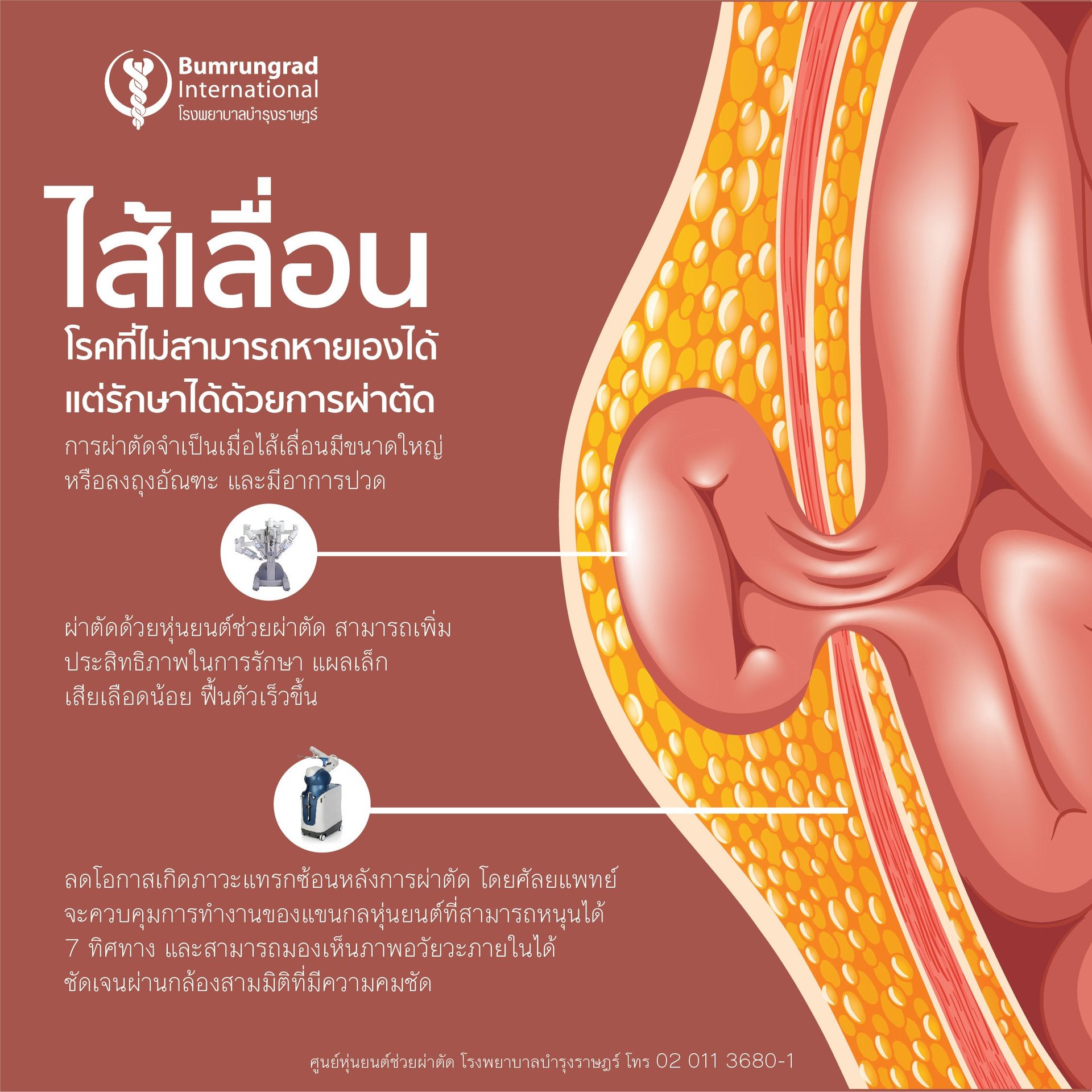 Infographic_hernia1080x1080.jpg