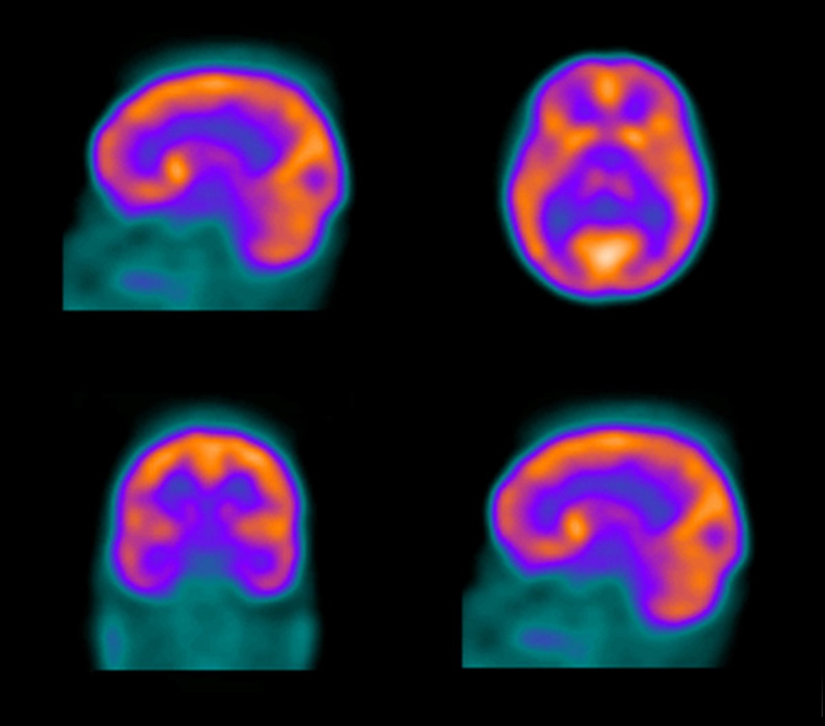 Nuclear-Medicine.jpg