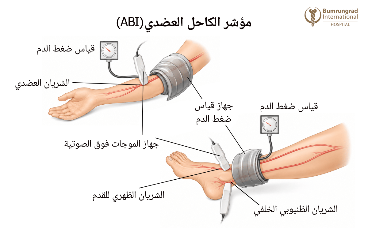 Wound-Care-Tests-Explained-ABI,-TBI,-and-TCOM-2-image-1-AR.png
