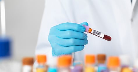 PRP Explained: Healing Injuries with Platelet-Rich Plasma Therapy