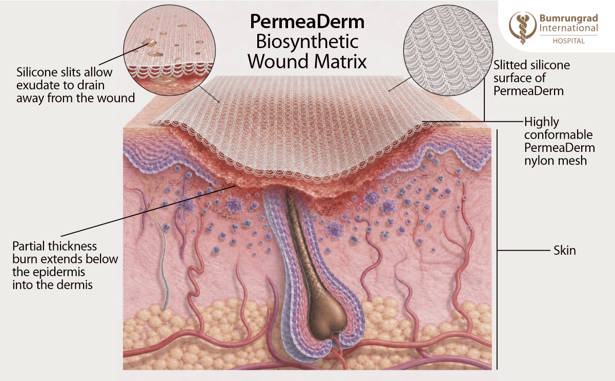 Advanced-Wound-Dressing-for-Chronic-and-Non-Healing-Wounds-Image-3.png