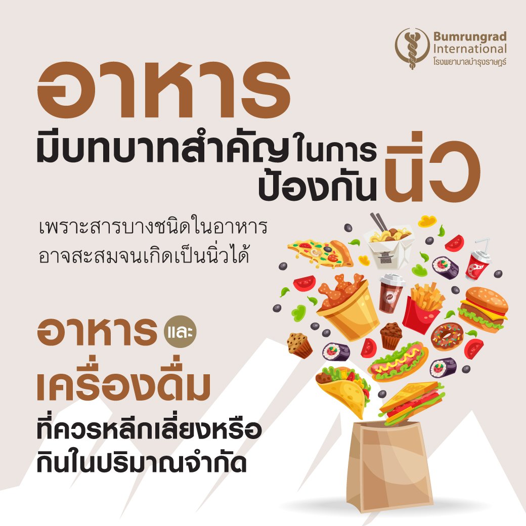 Layout-Daily-kidney-stone-prevention-tips-2_SM1.jpg