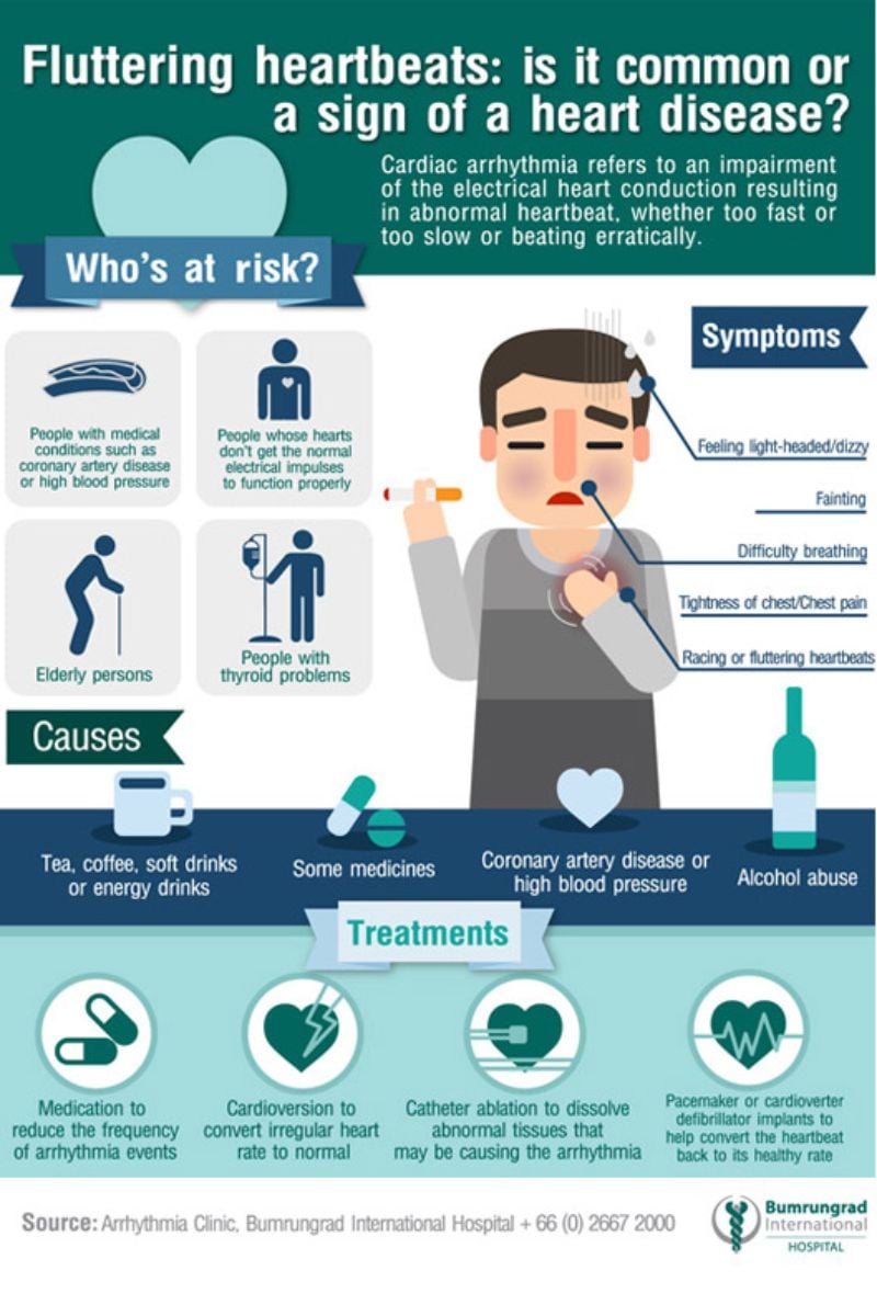 arrhythmias