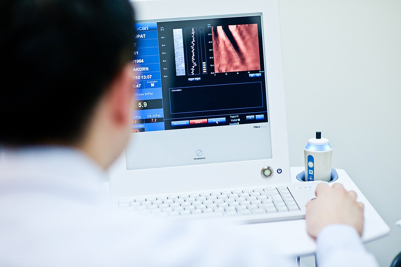 FibroScan.jpg FibroScan.jpg