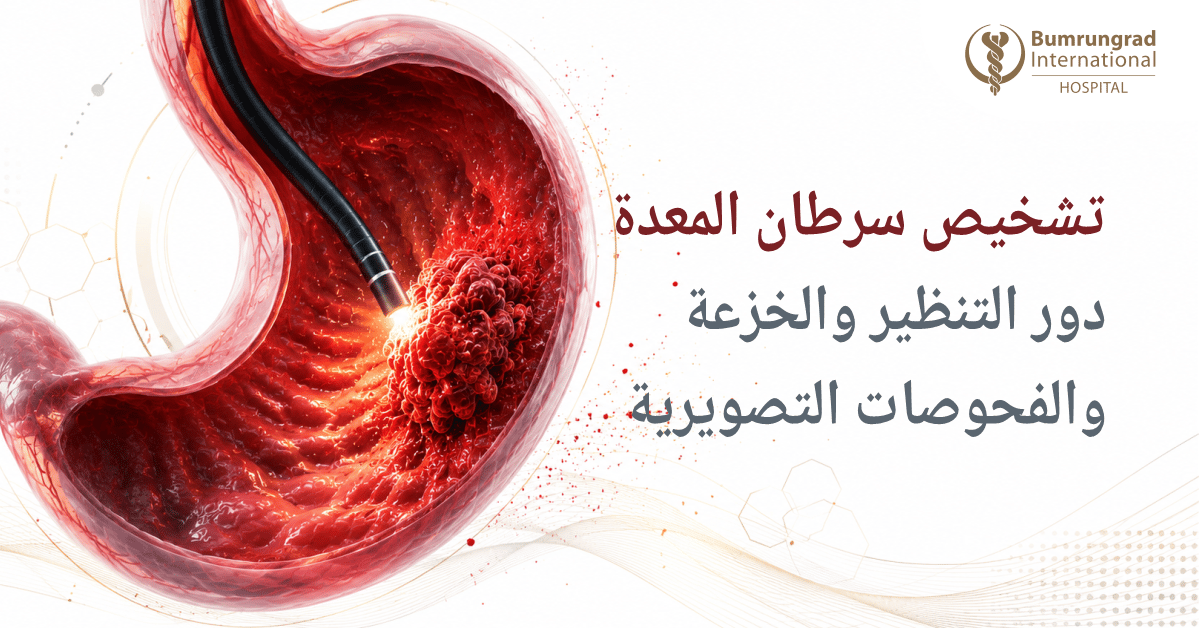 تشخيص سرطان المعدة: دور التنظير والخزعة والفحوصات التصويرية