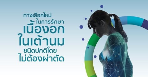 ก้อนเนื้องอกชนิดปกติ รักษาได้ด้วยการจัดความเย็นจัด