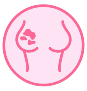 Digital Mammogram + Breast