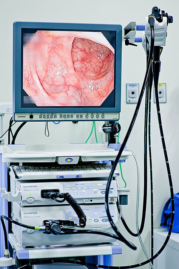 Colonoscopy Camera Size Colonoscopy Camera Size