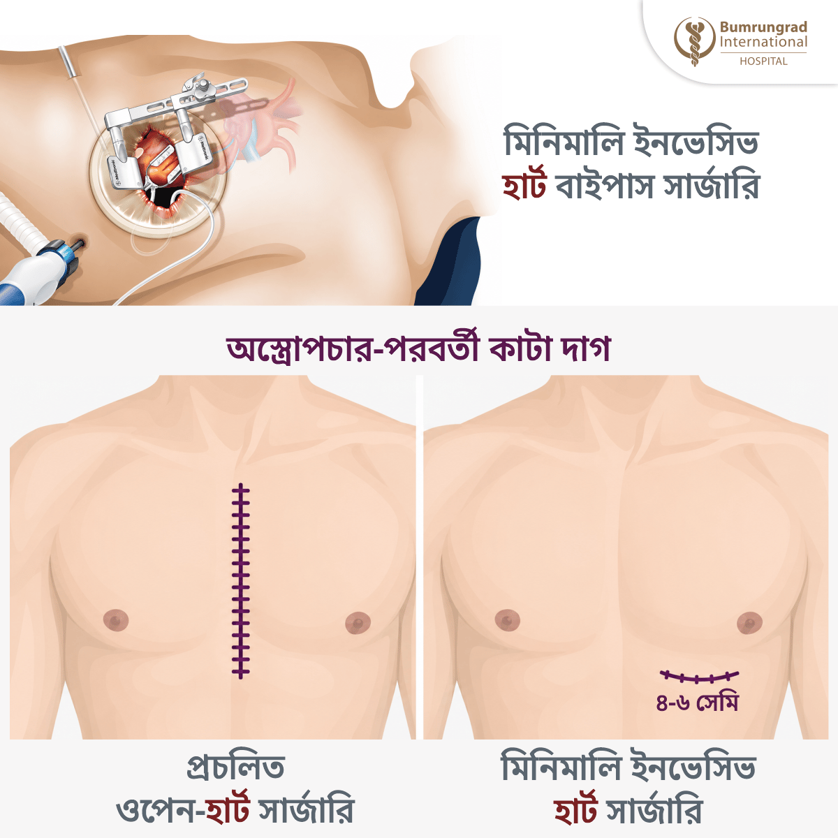 Heart Heart-infographics-BN.png