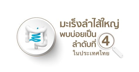 มะเร็งลำไส้ใหญ่ รู้ไว รักษาได้ ด้วยการส่องกล้องลำไส้ใหญ่