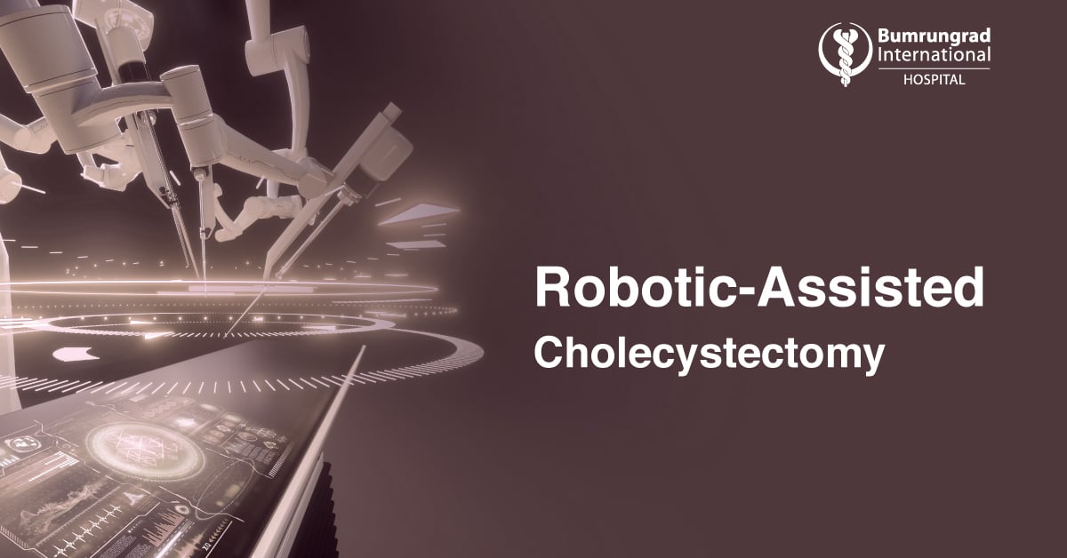 Roboticassisted cholecystectomy