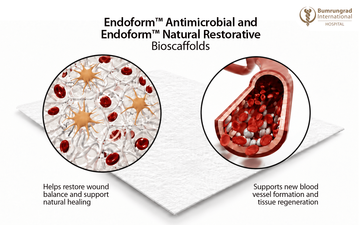 Advanced-Wound-Dressing-for-Chronic-and-Non-Healing-Wounds-Image-4.png