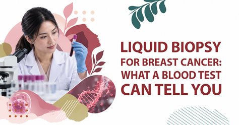 Liquid Biopsy for Breast Cancer: What a Blood Test Can Tell You