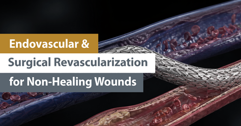 Endovascular and Surgical Revascularization for Non-Healing Wounds
