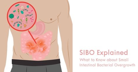 SIBO Explained: What to Know about Small Intestinal Bacterial Overgrowth