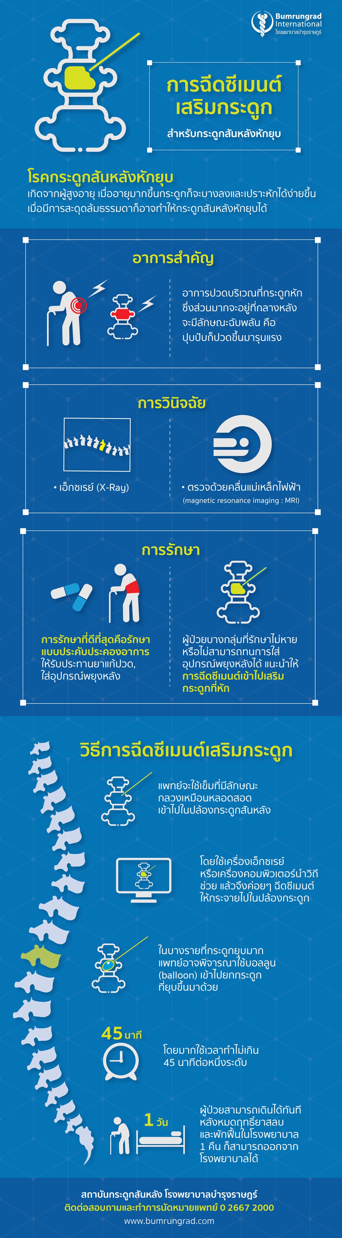 การฉีดซีเมนต์เสริมกระดูก กระดูกสันหลังหักยุบ infographic