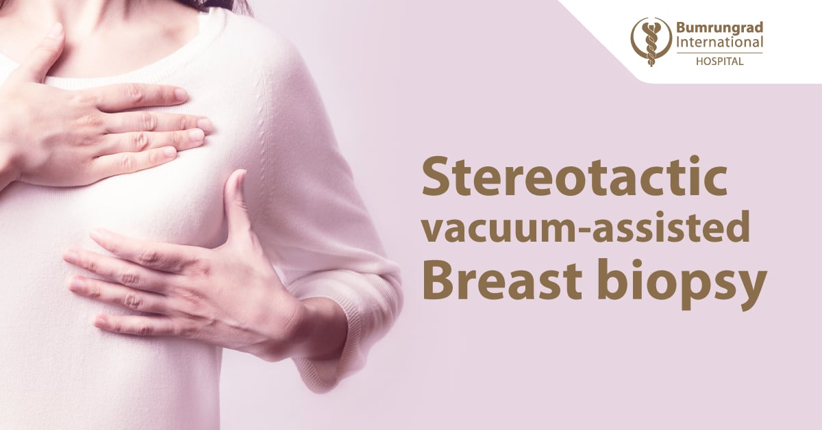 Layout-Mammogram-Online-Package_Stereotactic-vacuum-assisted-breast-biopsy-EN.jpg