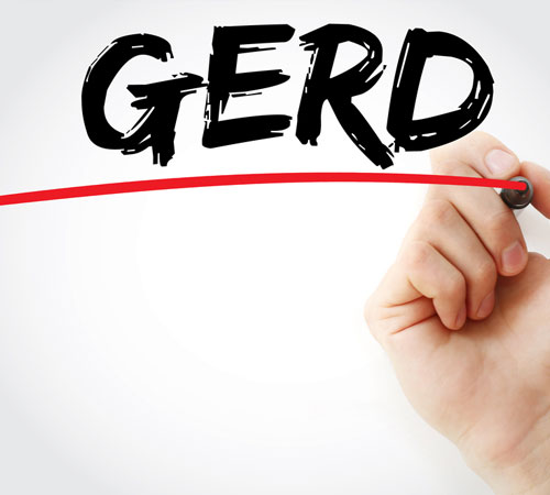gerd-500x450-(1).jpg gerd-500x450-(1).jpg
