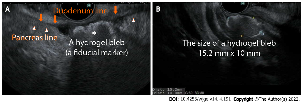 duodenum_line.png