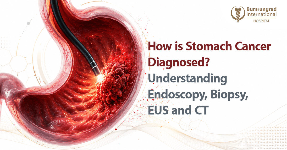 How Is Stomach Cancer Diagnosed? Understanding Endoscopy, Biopsy, EUS and CT