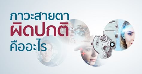 ภาวะสายตาผิดปกติ เกิดขึ้นได้อย่างไร