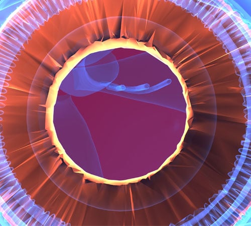 What-You-Need-to-Know-About-Glaucoma-500x450.jpg What-You-Need-to-Know-About-Glaucoma-500x450.jpg