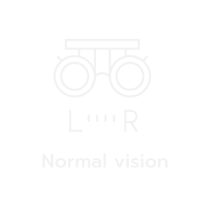 Layout-Eye-Center_Normal-vision-EN-(1).png